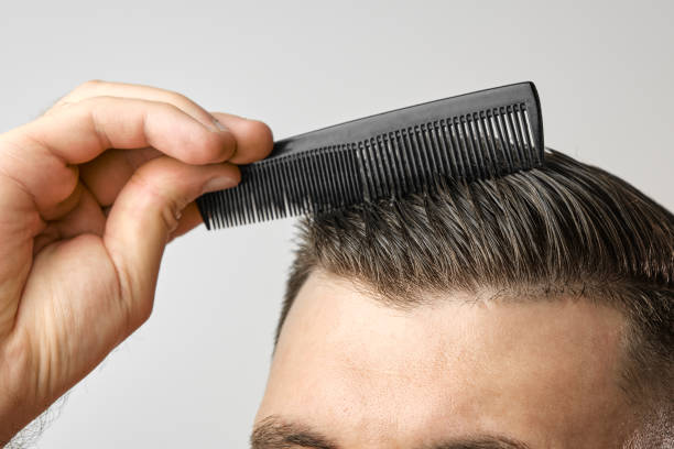 Hair Transplant Turkey Cost: Real Patient Price Examples